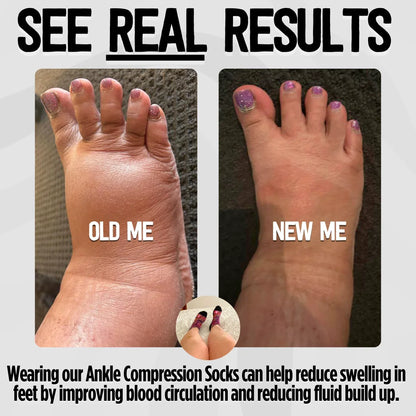 GRIP Ankle Compression Socks Floral Patches Bamboo